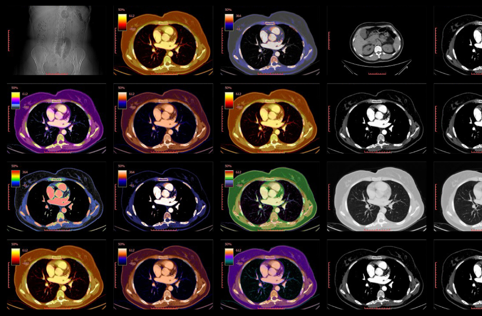 Digital radiography in the age of smart imaging: Rethinking exposure ...